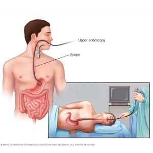 Gastroskopi İşlemi