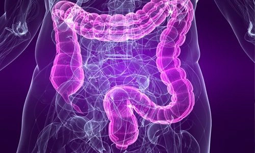 Kolon Kanseri Nedir? Belirtileri, Evreleri ve Tedavisi